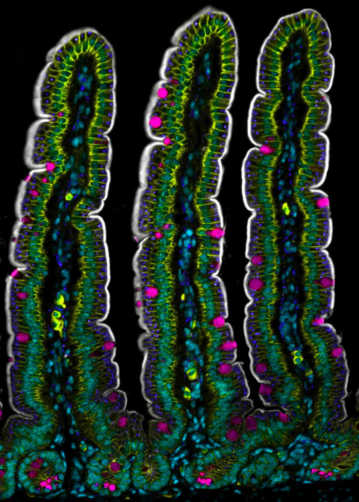 Intestine DPPIV Muc2 p120 Lamp1
