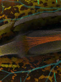 Timin magnified image