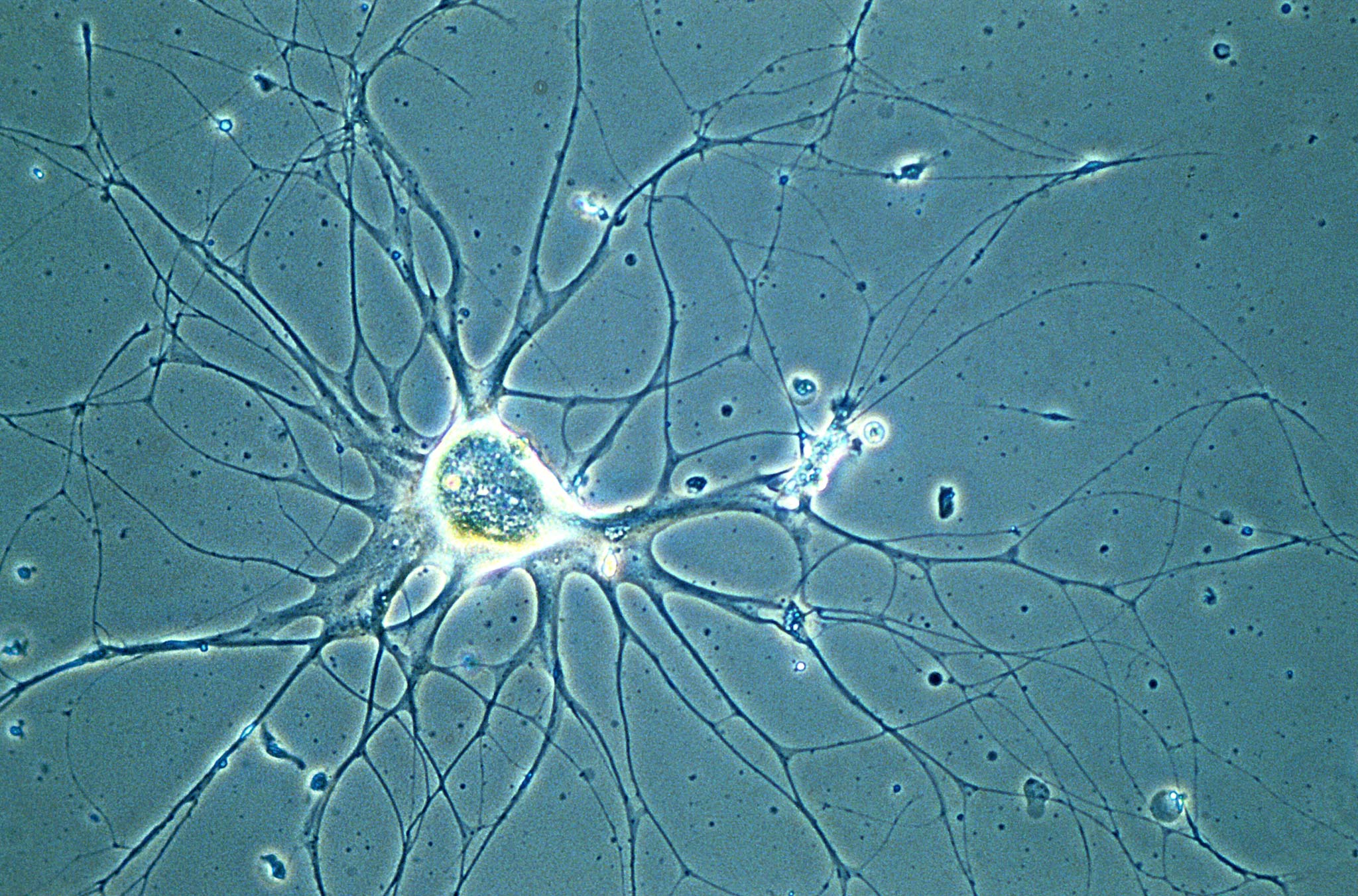 Snail neuron in cell culture Nikon’s Small World
