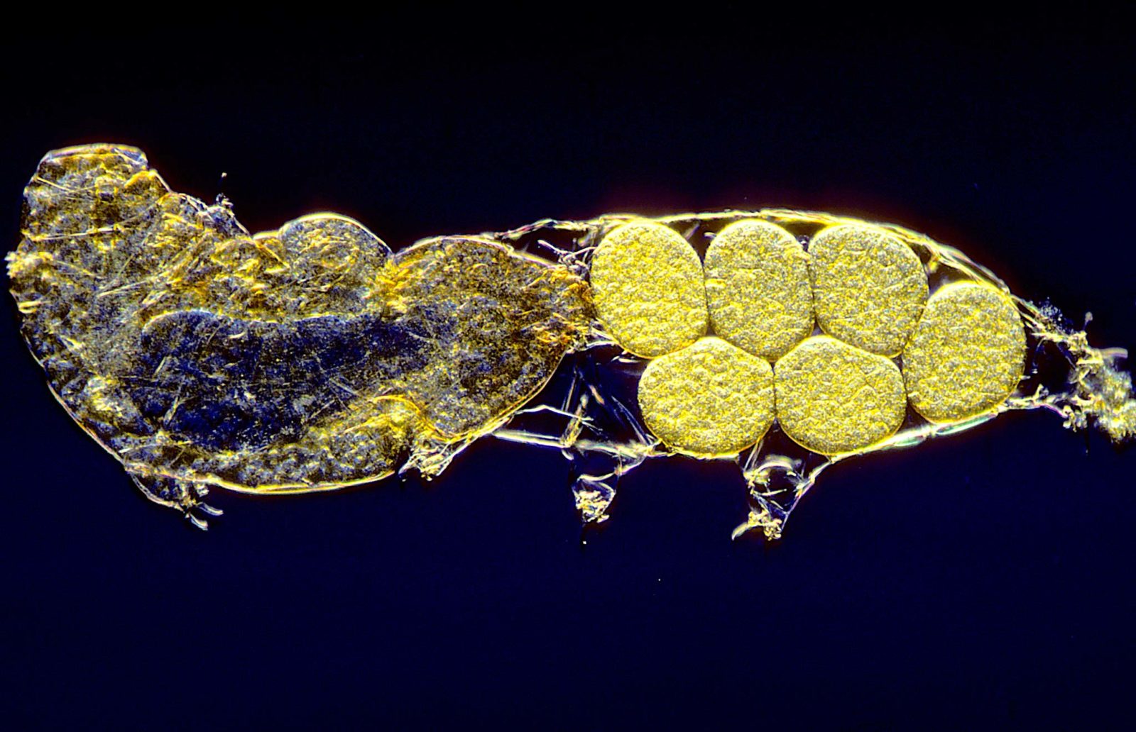 Water bear (sp. Milnesium tardigradum) with molting eggs in exoskeleton