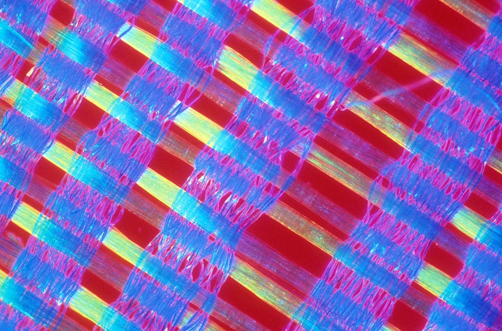 Synthetic woven fabric | 1992 Photomicrography Competition | Nikon’s ...