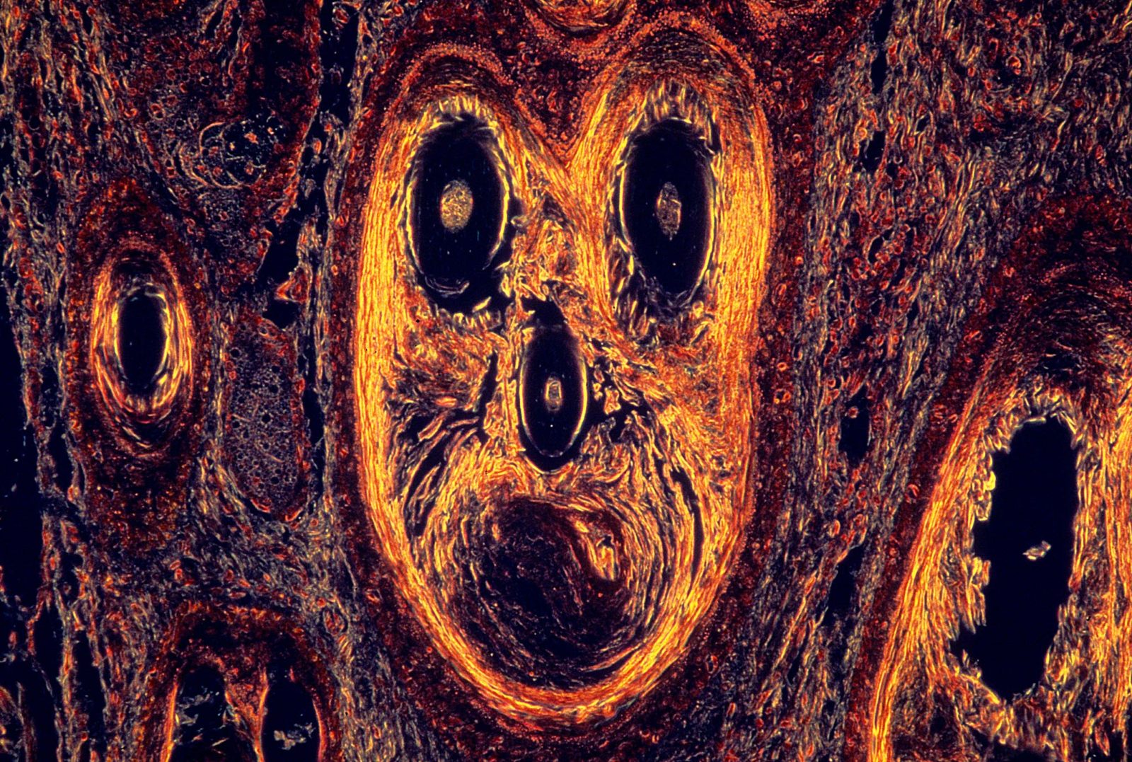 Canine compound hair follicle - dermis | Nikon Small World