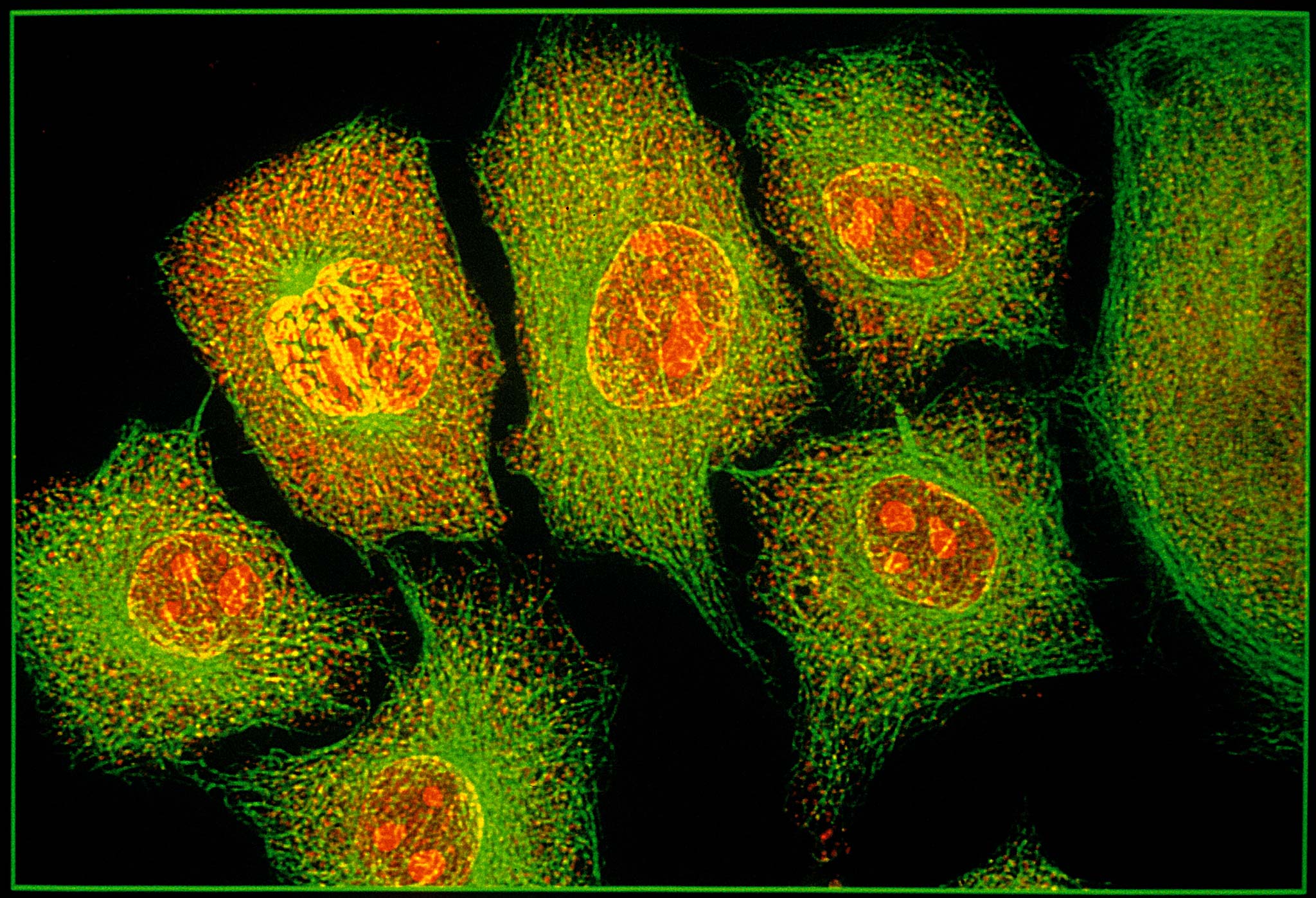 HeLa tissue culture cells | Nikon’s Small World