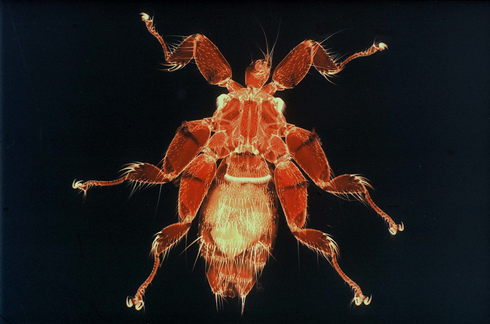 Nycteribia sp. (parasite of bat) Nikon’s Small World