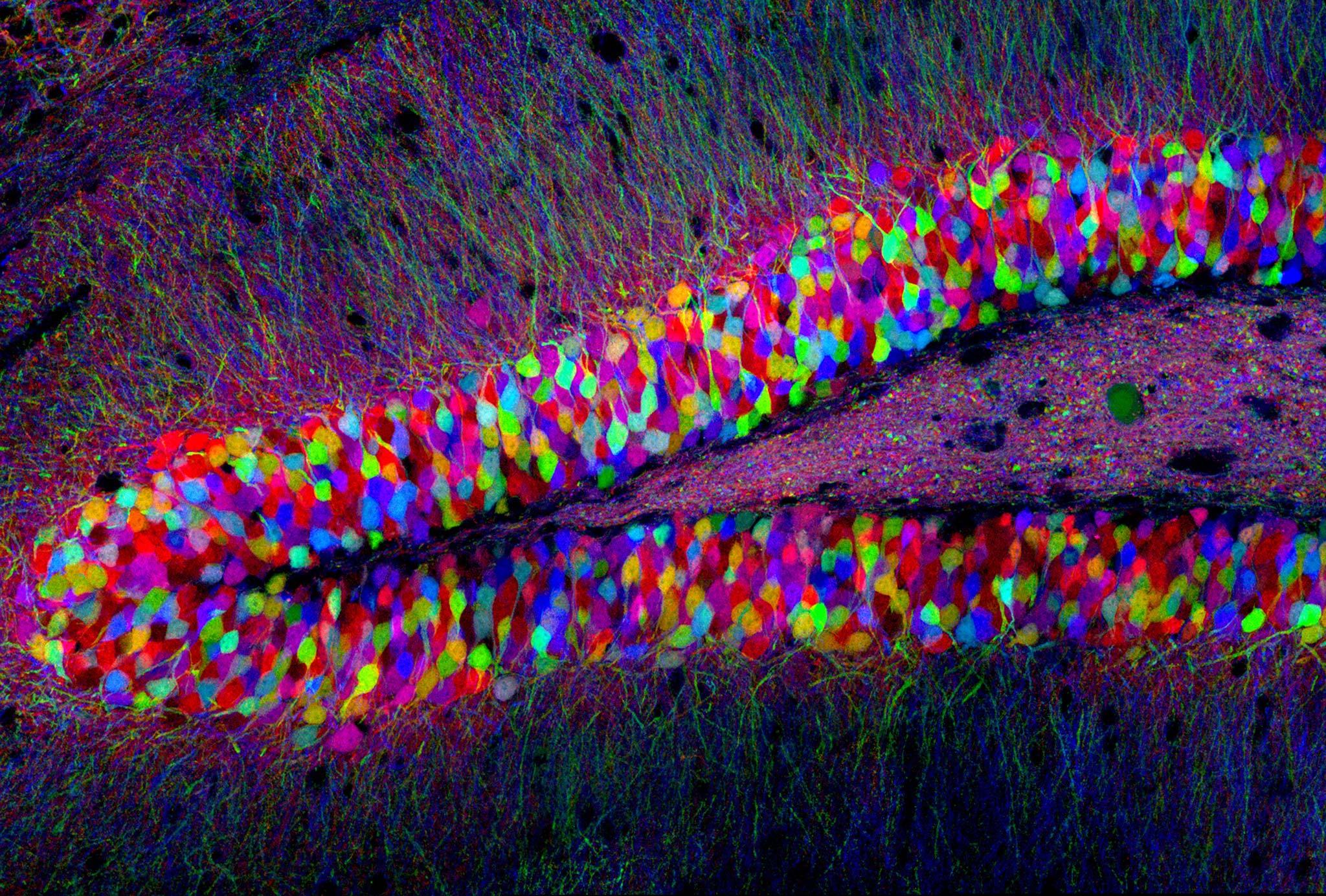 Brainbow “Brainbow” transgenic mouse hippocampus | Nikon Small World