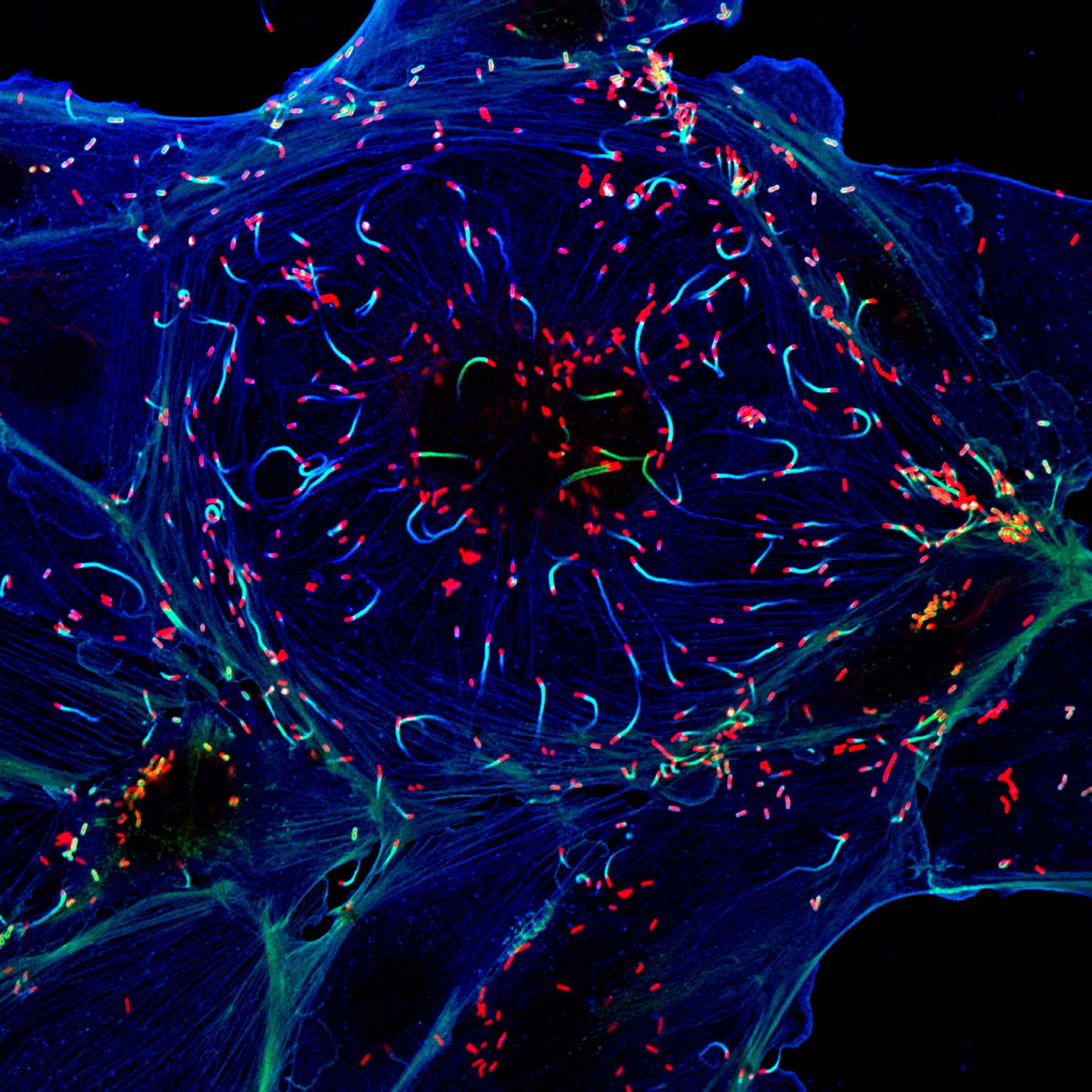 Listeria monocytogenes polymerizing host cell actin into comet tails