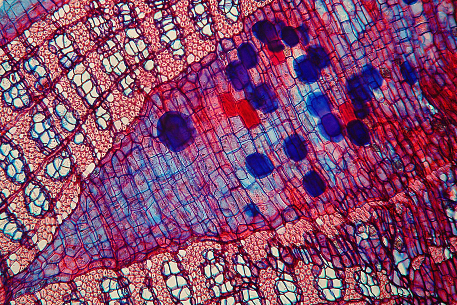 Клетка человека изображение. Сетчатка Филина микрофотография. Tilia Stem микроскоп. Микрофотография клетки человека. Ксилема микрофотография.