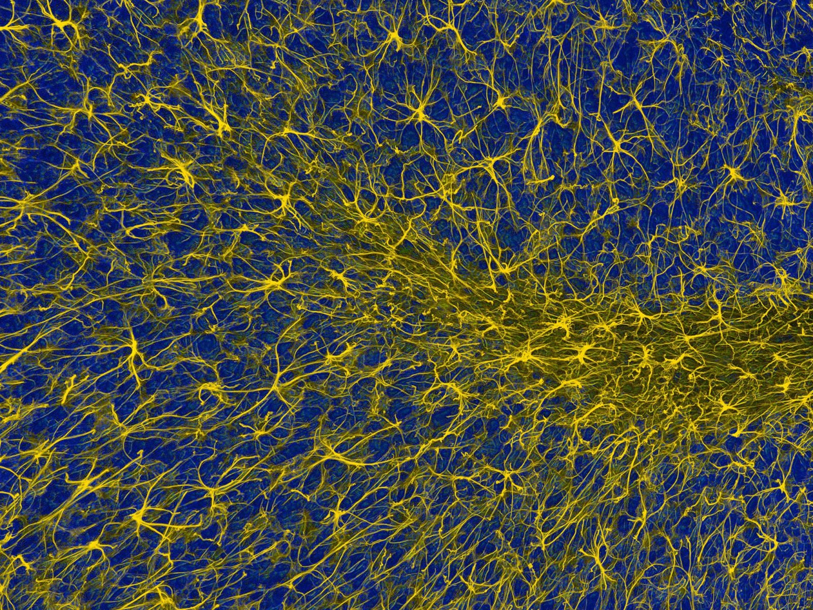 Ткань мозжечка. Нервные клетки микрофотография. Нейрон Пуанкаре микрофотография. Клетки мозжечка в электронный микроскоп. Нейронные микросети.