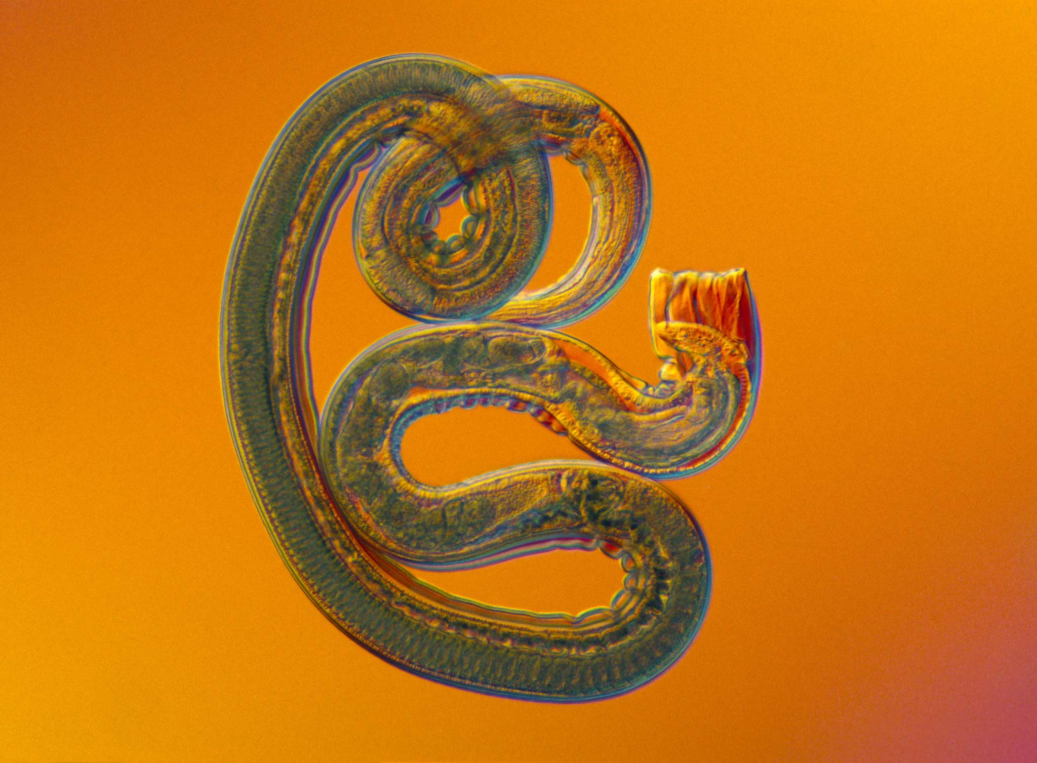 Nippostrongylus brasiliensis (rat nematode parasite) Nikon’s Small World