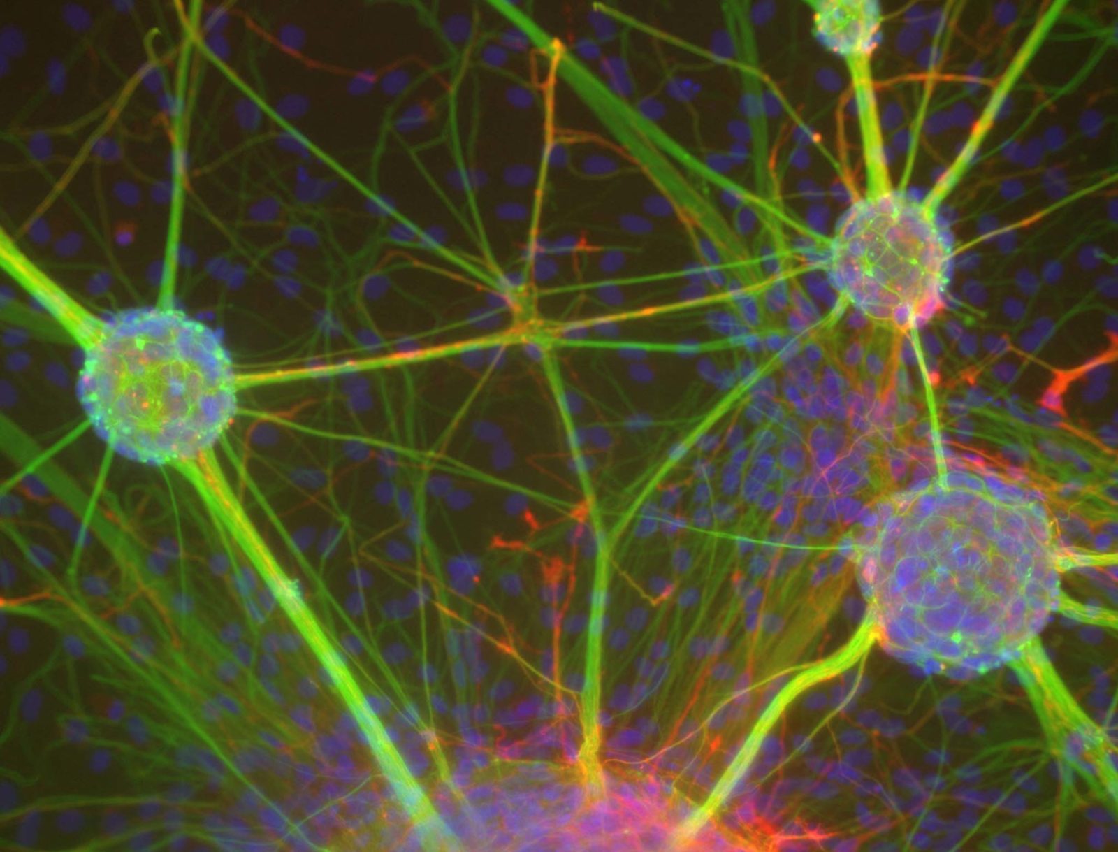 Neurasphere Primary rat neurons grown as neurospheres | Nikon Small World