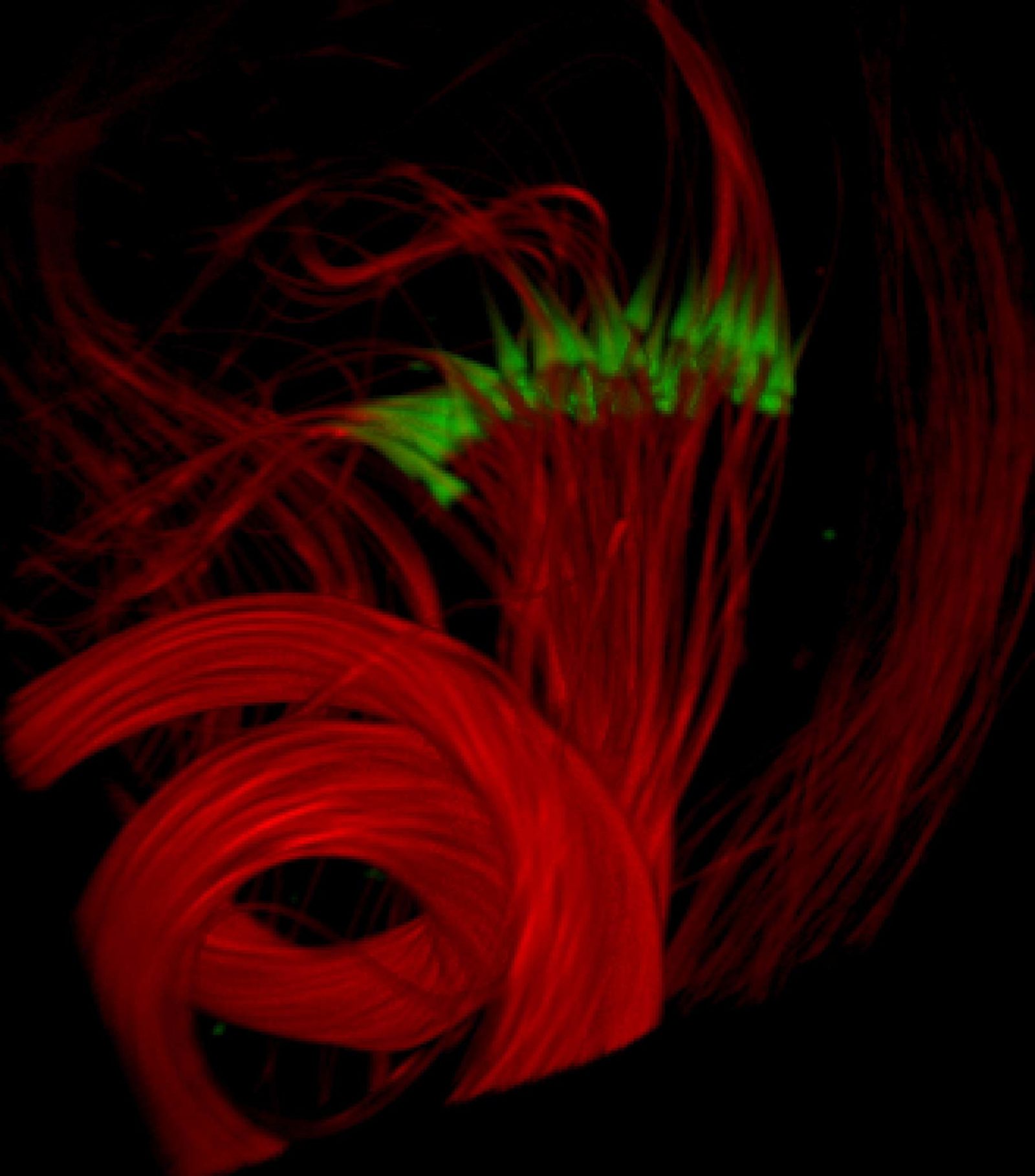 Drosophila melanogaster (fruit fly) sperm individualization, fixed