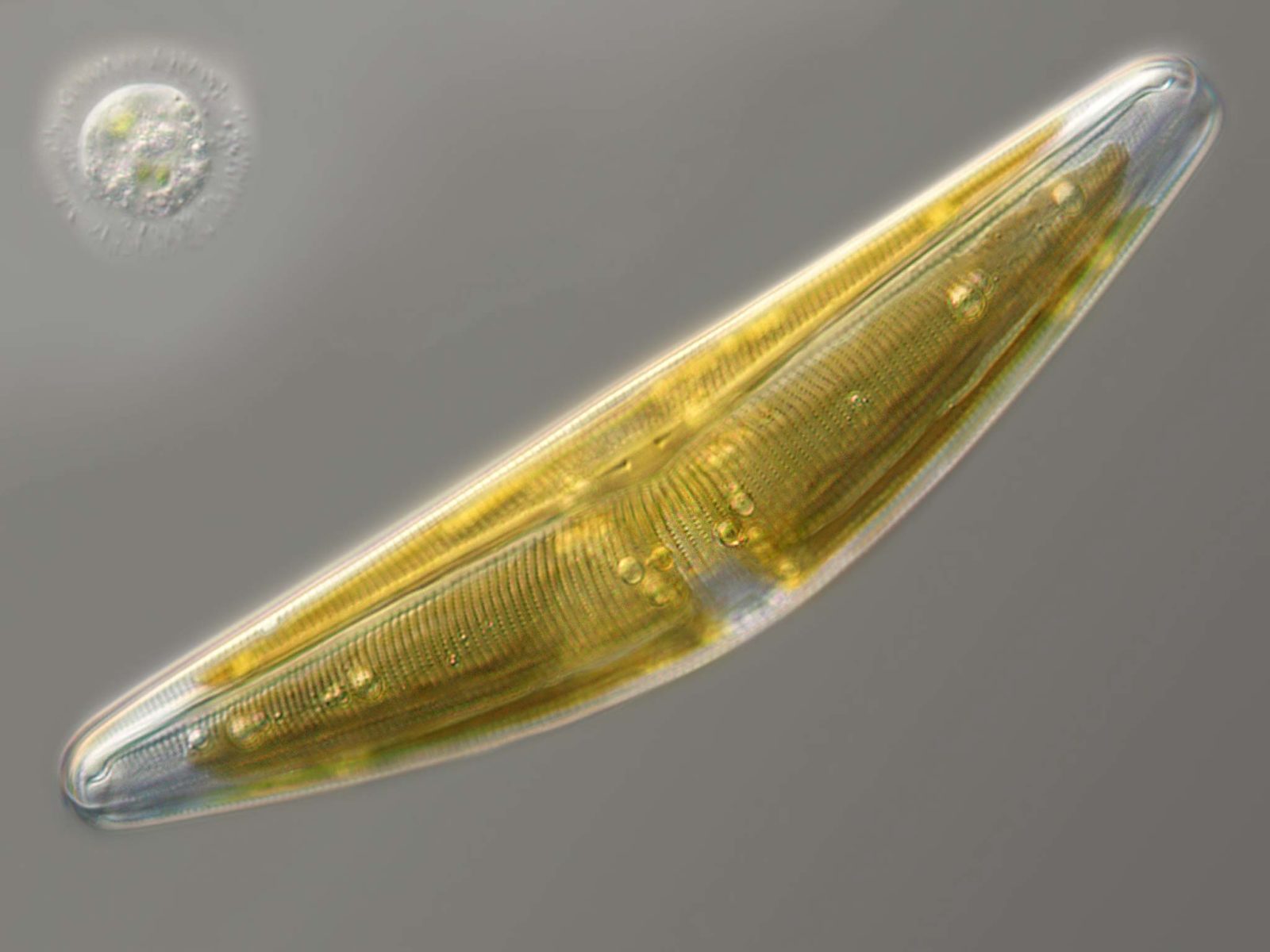 Cymbella (diatom) together with Cochliopodium (amoeba) | 2012  Photomicrography Competition | Nikon Small World, image size:1600x1200