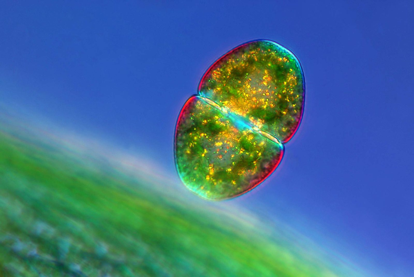 Солнечные бактерии. Микромир бактерии. Мир под микроскопом. Красивые бактерии. Фотографии микромира.