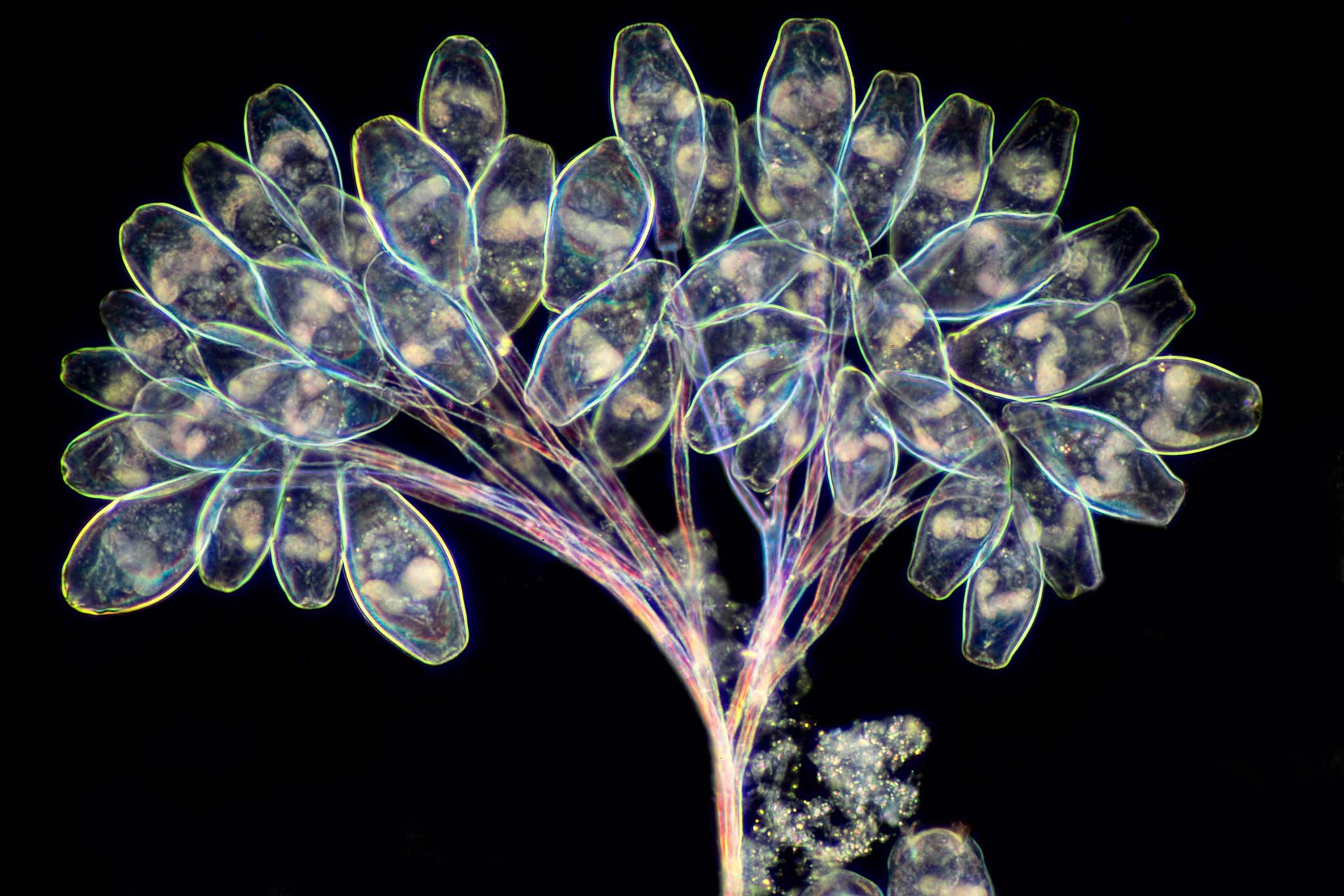Vorticella sp. (protozoa) Nikon’s Small World