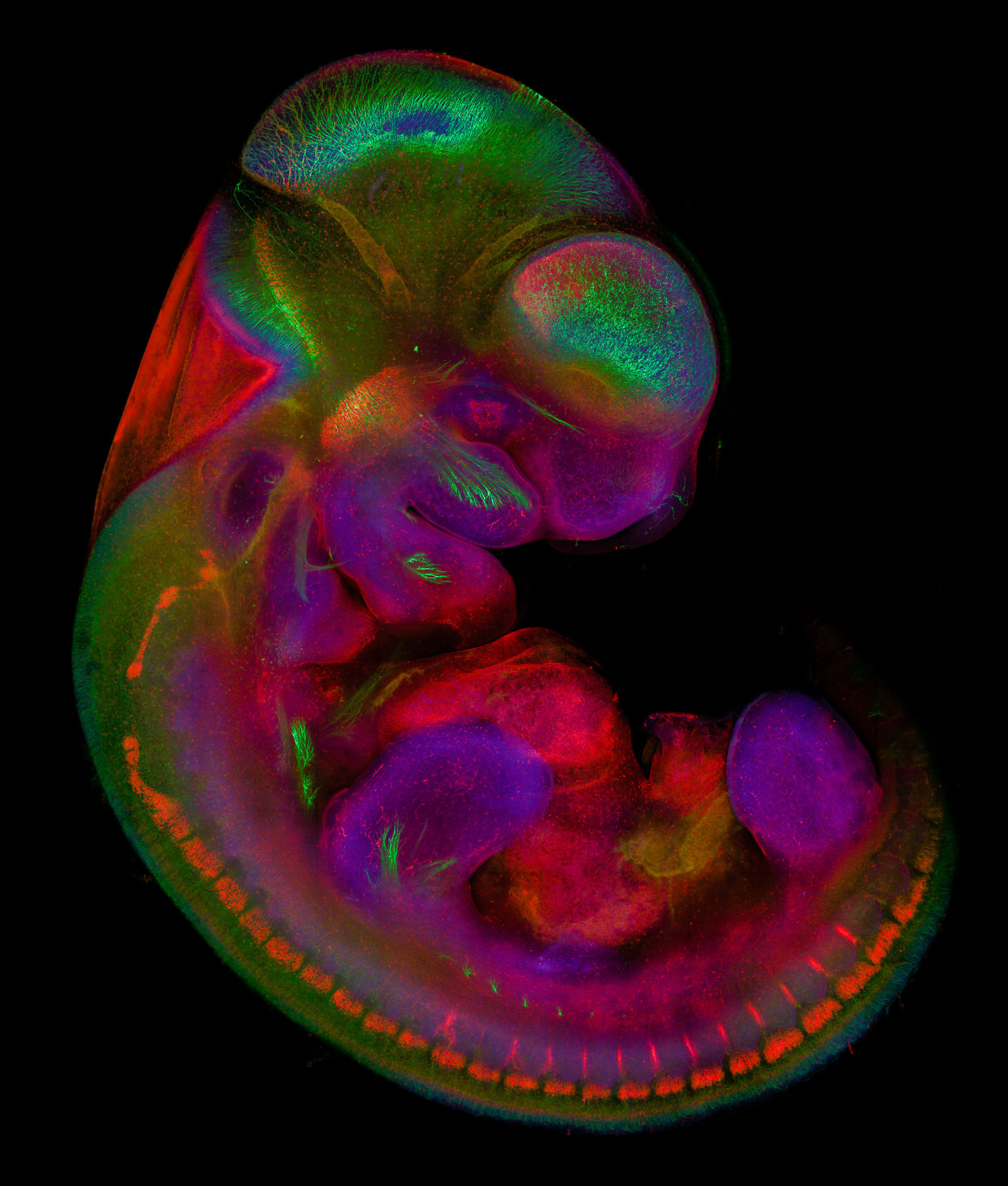 Mouse embryo, 10.5 days old Nikon’s Small World