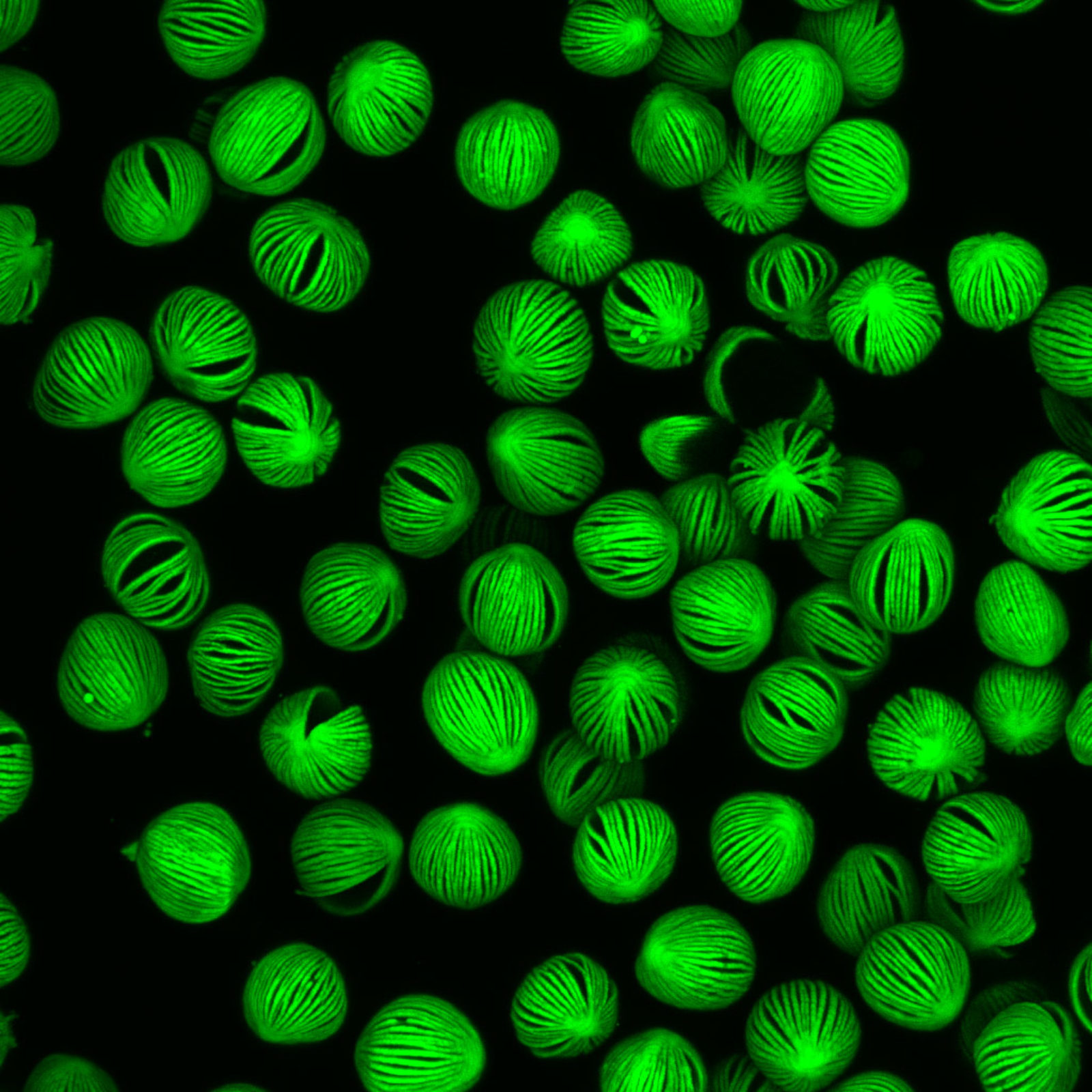 Pollen grains of a peace lily (Spathiphyllum sp.) Nikon’s Small World