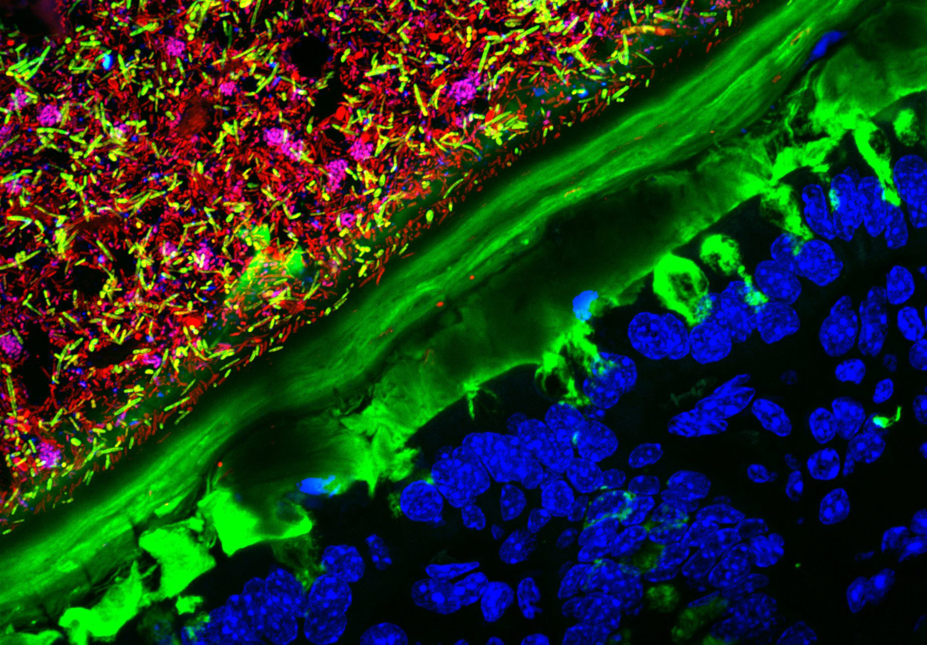 Mouse colon colonized with human microbiota | Nikon Small World