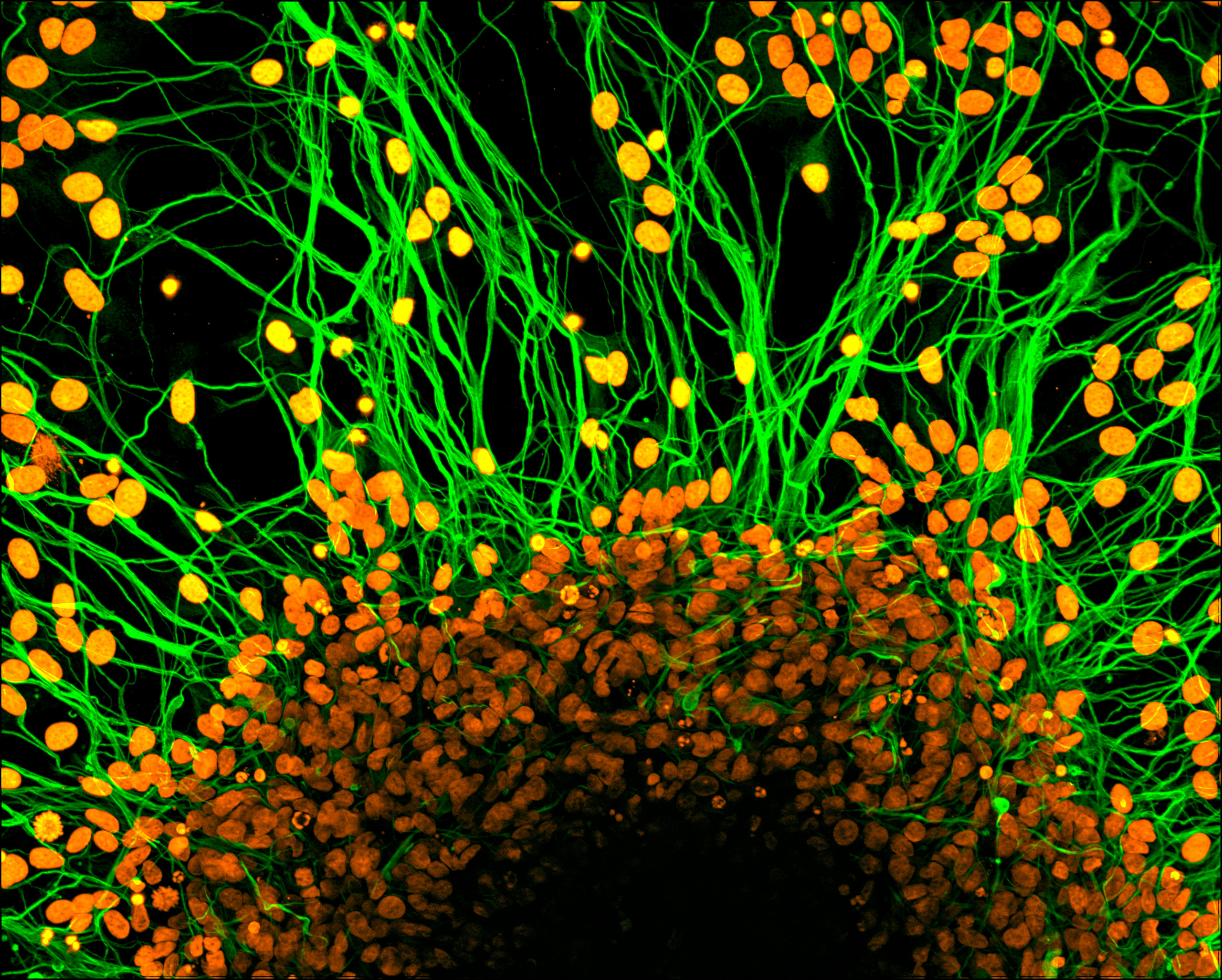 Ips Neuron Human sensory neurons derived from induced pluripotent stem (iPS) cells ...