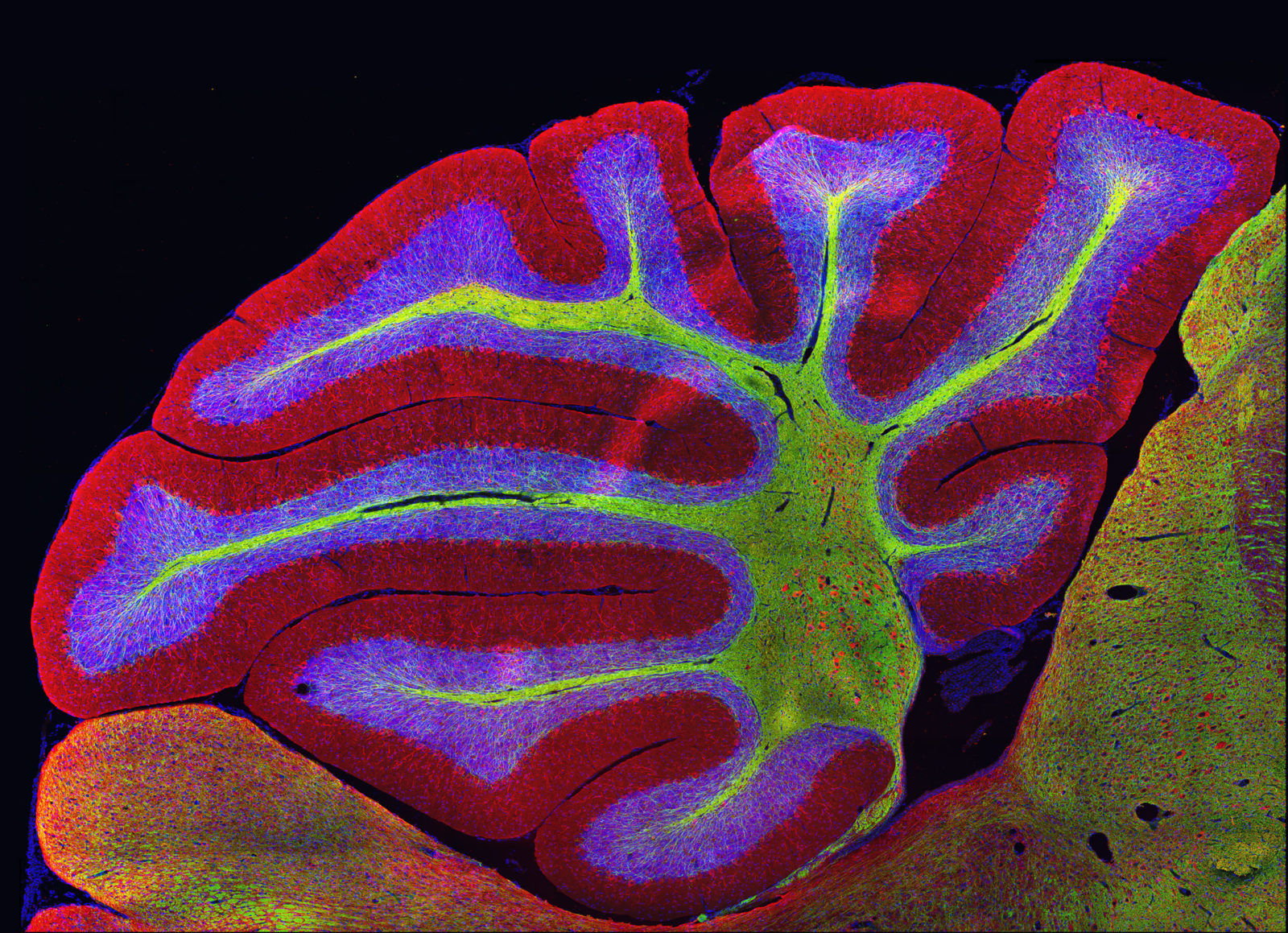 Sagittal section of mouse cerebellum (brain) | 2017