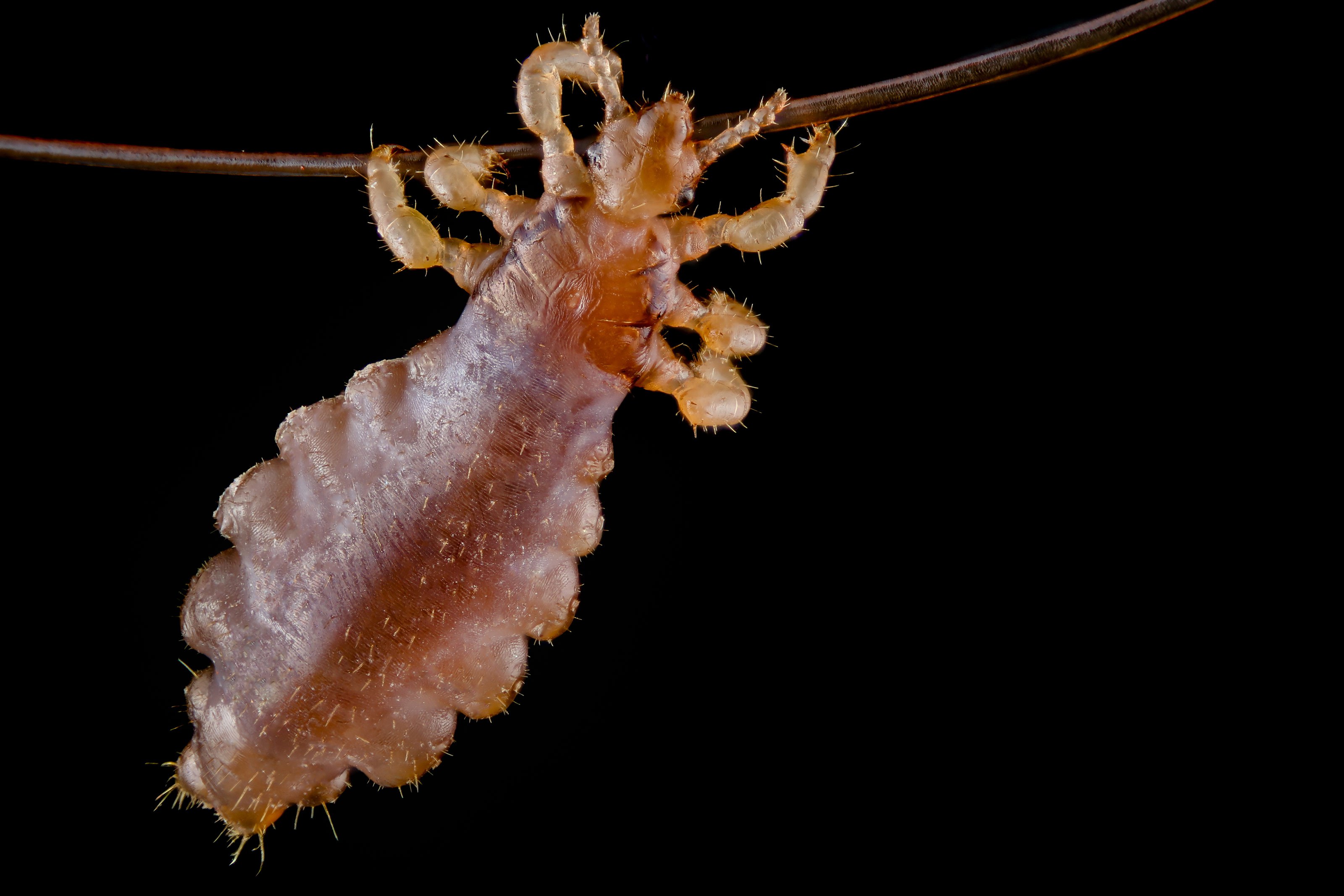 https://www.nikonsmallworld.com/images/photos/2019/Louse-hanging-from-a-hair.jpg