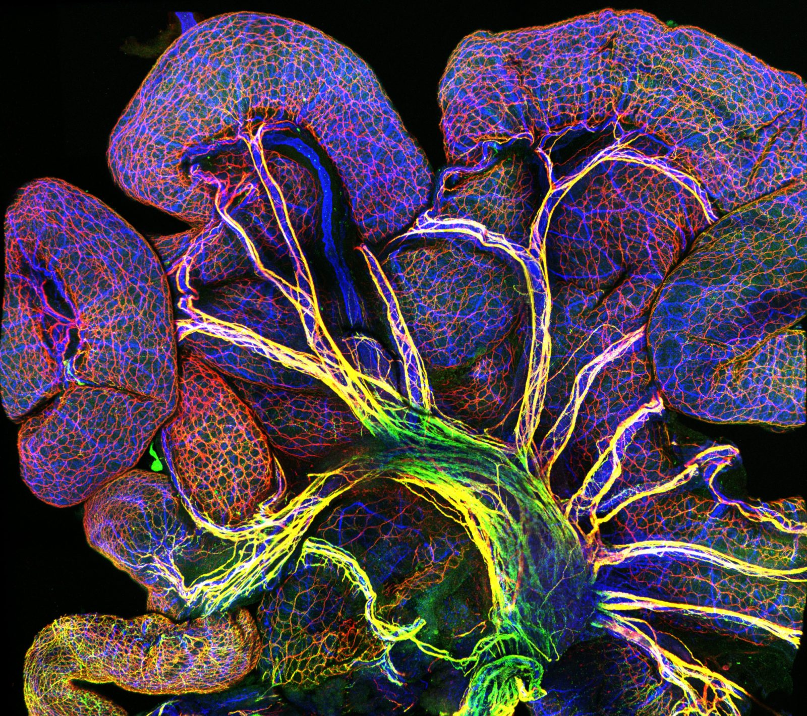 Как выглядит тестостерон под микроскопом Endothelial cells in intestine of an 18.5-day old mouse embryo Nikon’s Small Wor