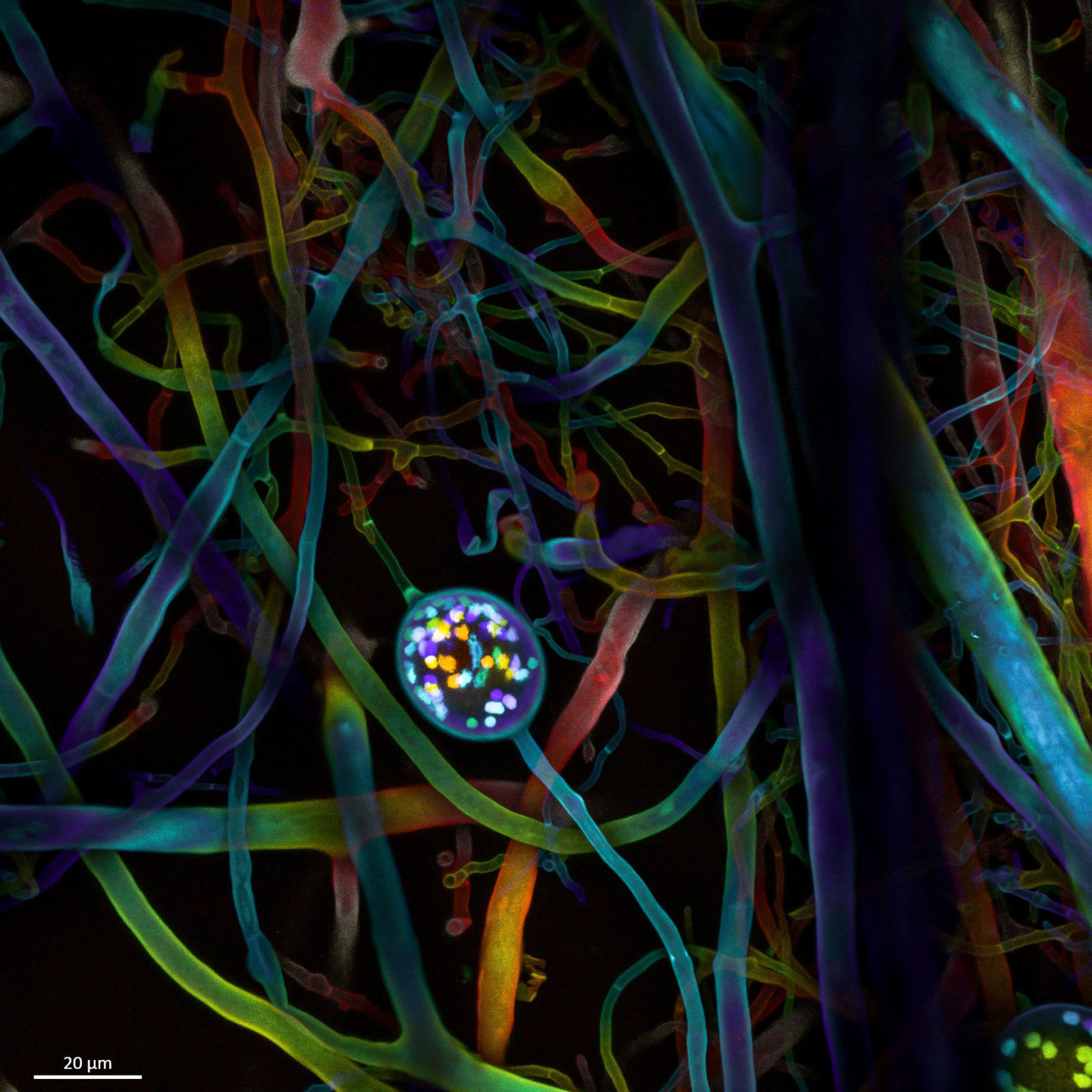 Multinucleate spores and hyphae of a soil fungus (arbuscular