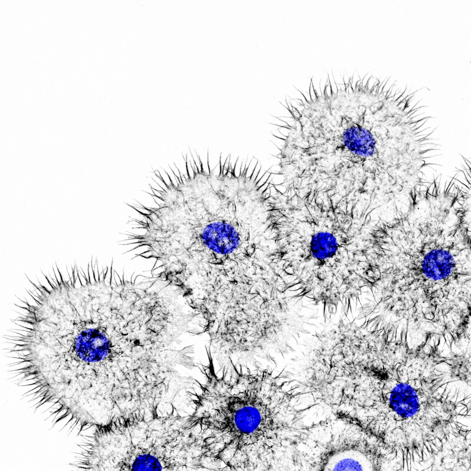 Ovarian cells of a cabbage moth with actin shown in grey and nuclei in ...