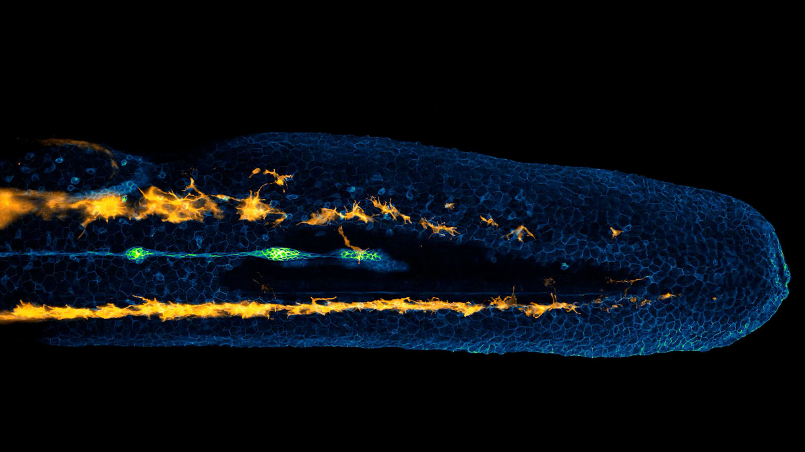 Lateral line cells and melanocytes migrating in a zebrafish embryo