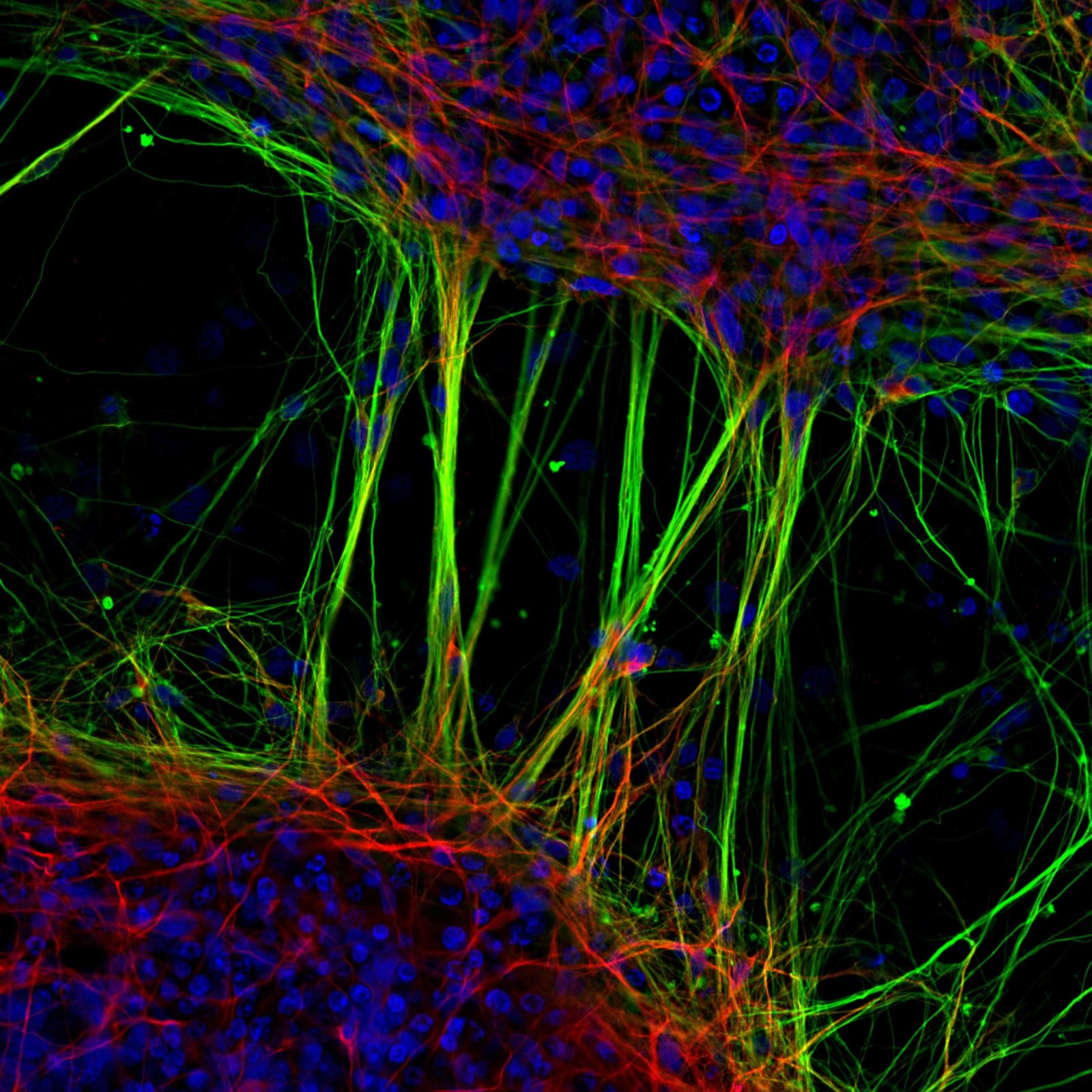 Human 2022. Nikon small World Photomicrography. Стволовые клетки микрофотография. Инфекции под микроскопом. Микрокосмос клетки.