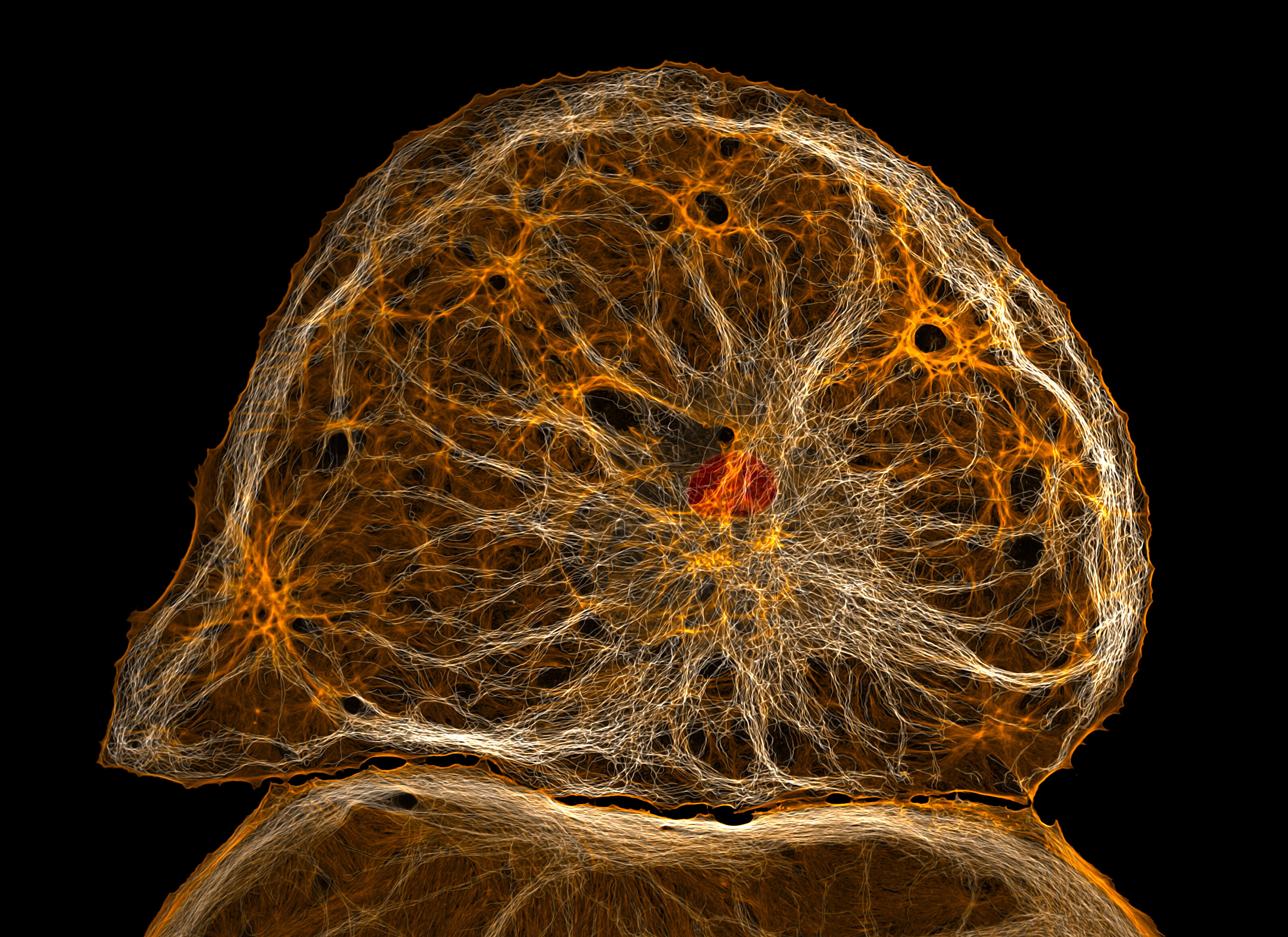 Dedifferentiated liver endothelial cell | Nikon Small World